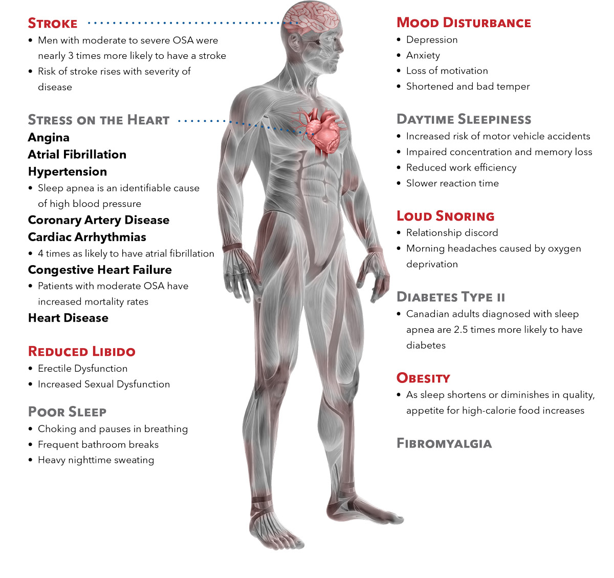 sleep apnea effects